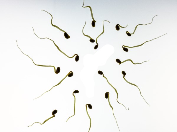 Concentration de spermatozoïde, sperme transparent